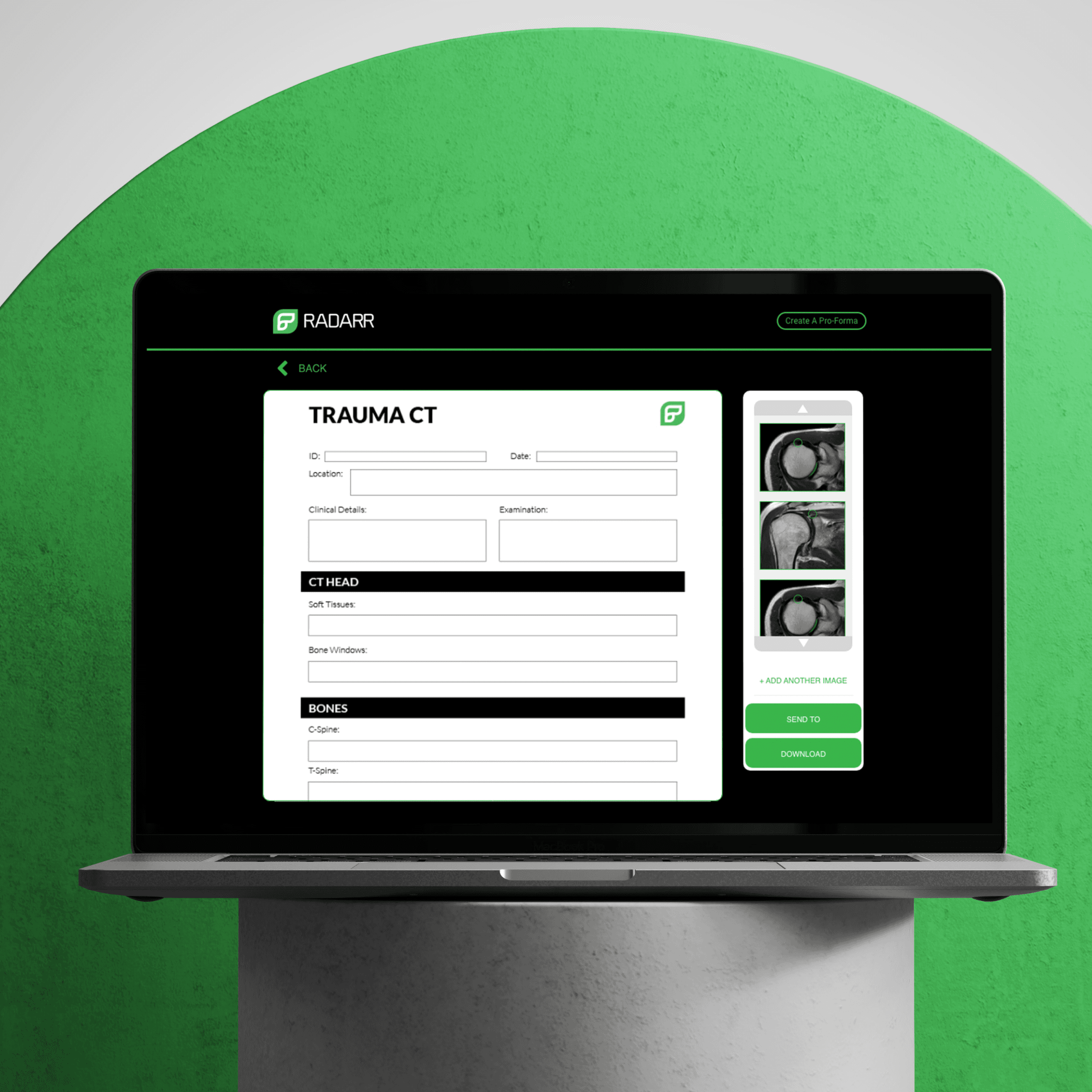 Radarr programme on macbook