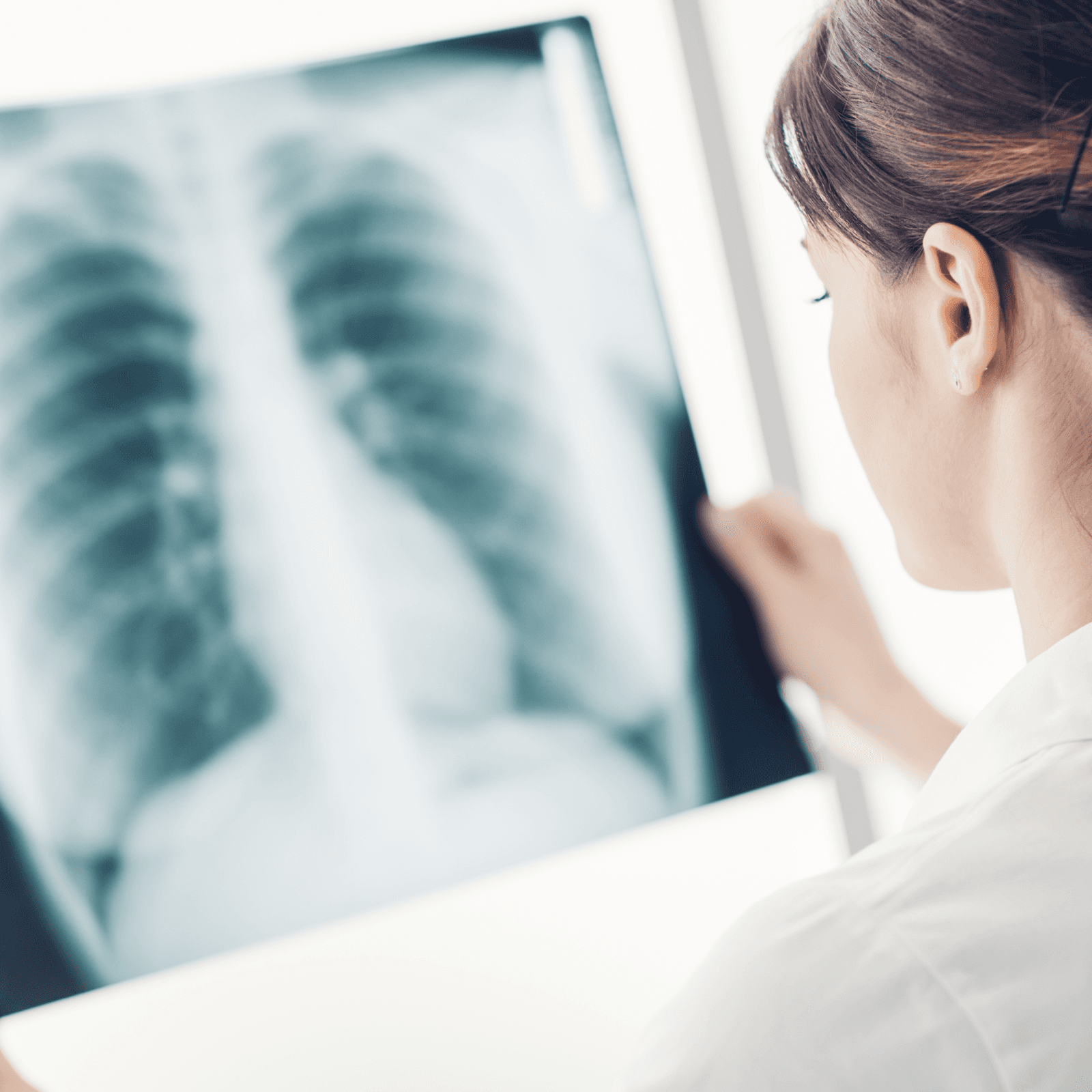 Doctor looking at an x-ray